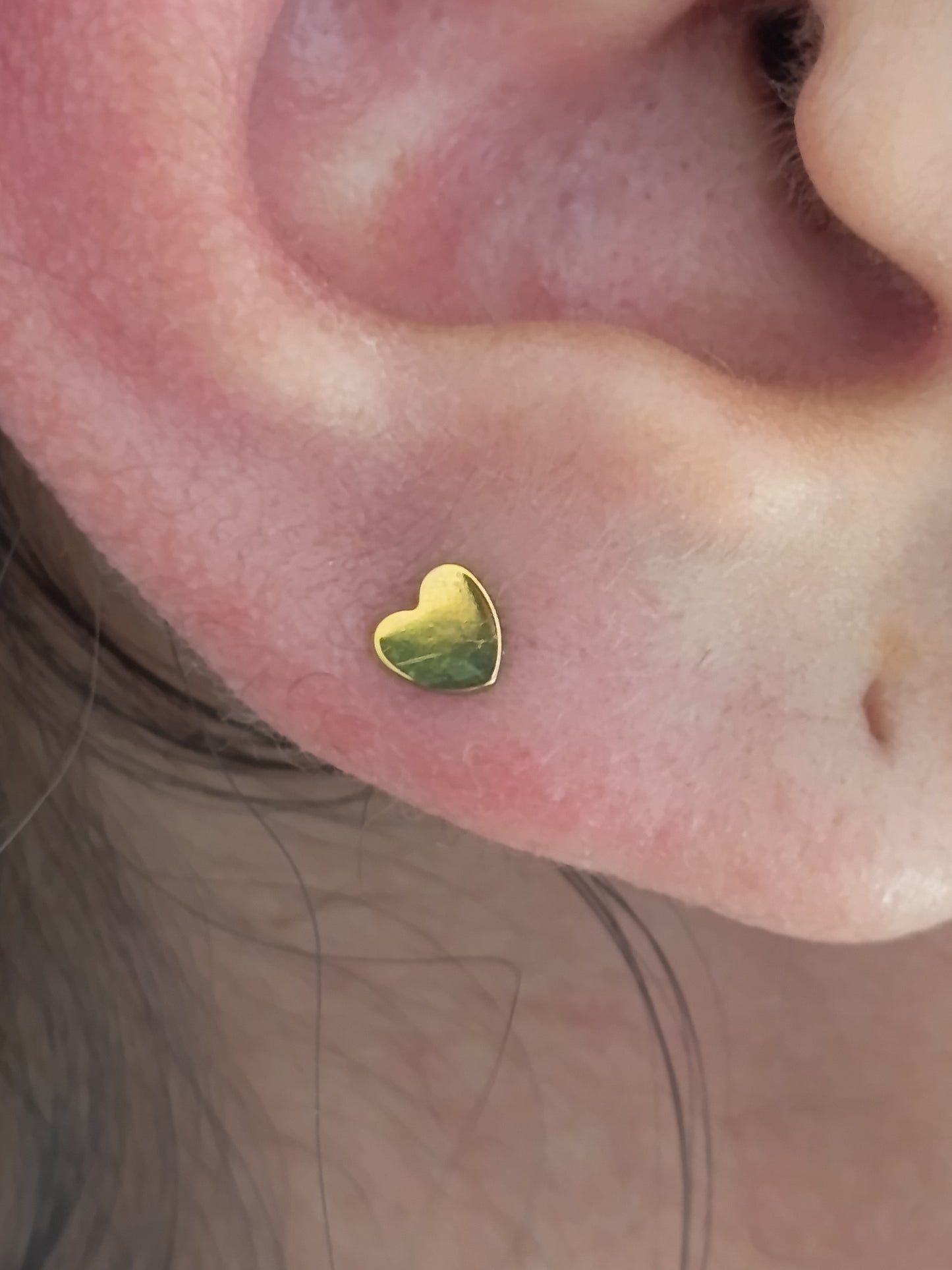 Corazón - titanio grado implante ASTM F-136