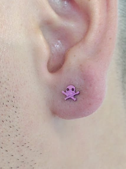 Calavera con huesitos - titanio grado implante ASTM F-136